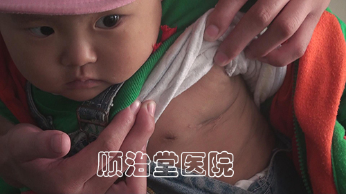 肿瘤患者康复
